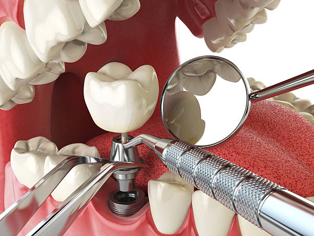 Best Dental Abscess Treatment in Conway, AR